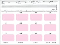 ECF-ECG MOUNTING FORM ECF 2301 ECG MOUNT SHEET 8-1/2 X 11