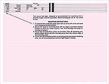 ECF-ECG MOUNTING FORM ECF 7909 ECG MOUNT SHEET 8-1/2 X 11